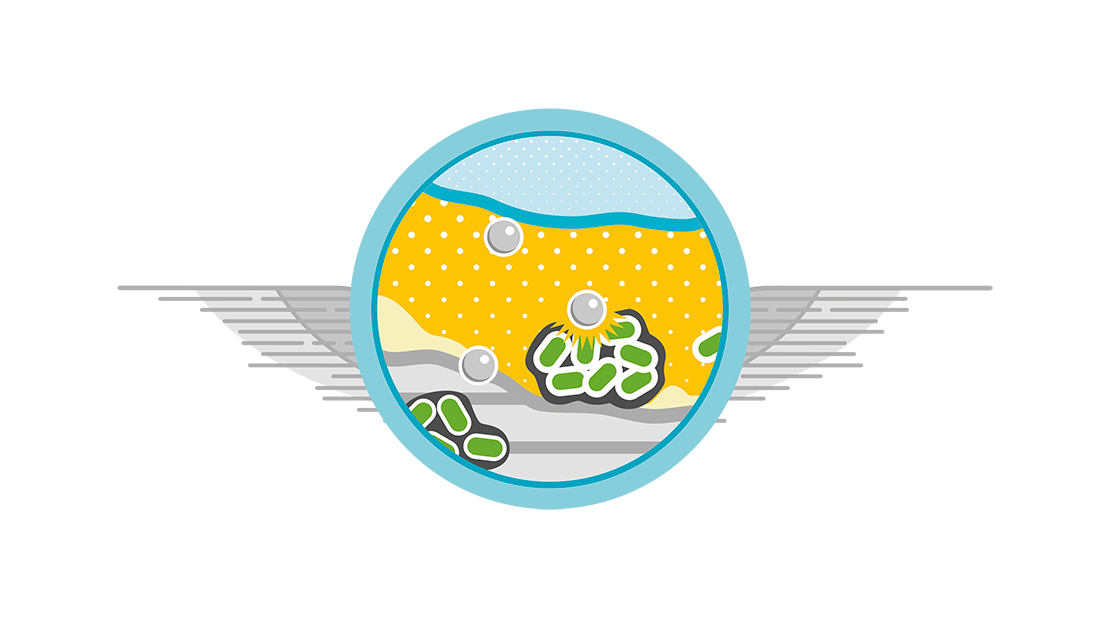 When to use a silver dressing?