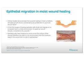 Module 3 - Moist Wound Healing