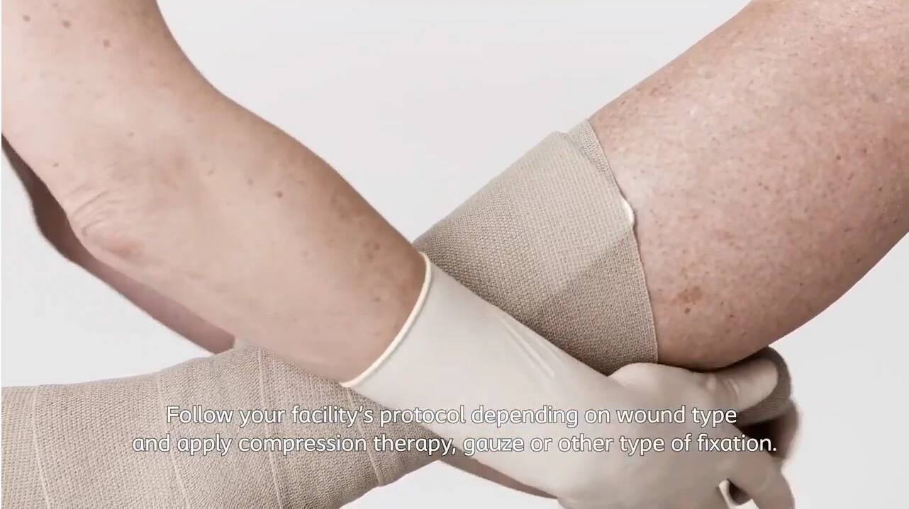 How are foam dressings formed and how do they work?