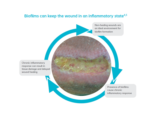 How do biofilm affect wound healing?