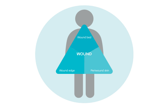 The three key areas of the wound