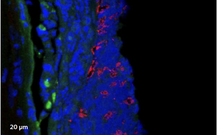 Confocal laser scanning microscopy (CLSM)