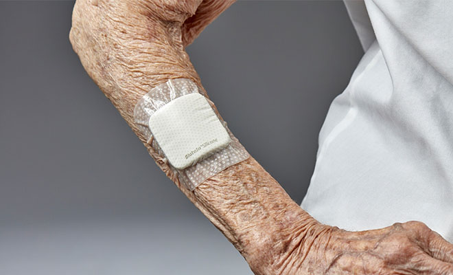 The Four Stages of Wound Healing