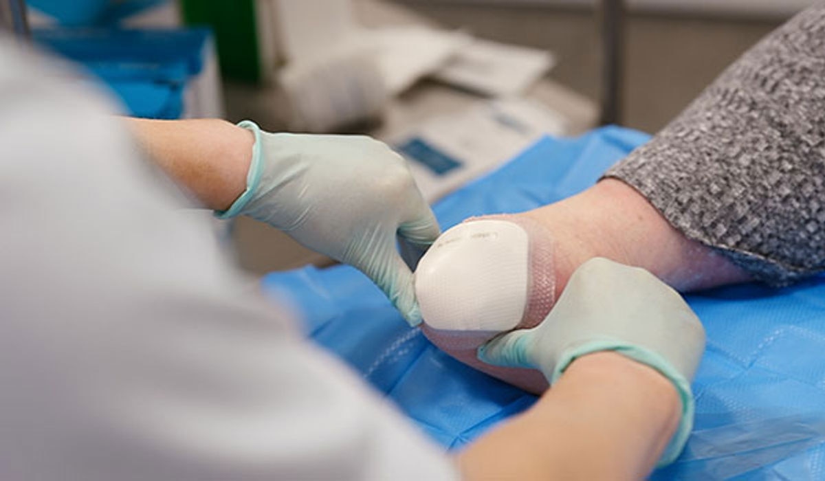 Discover Biatain® Silicone Ag with 3DFit Technology