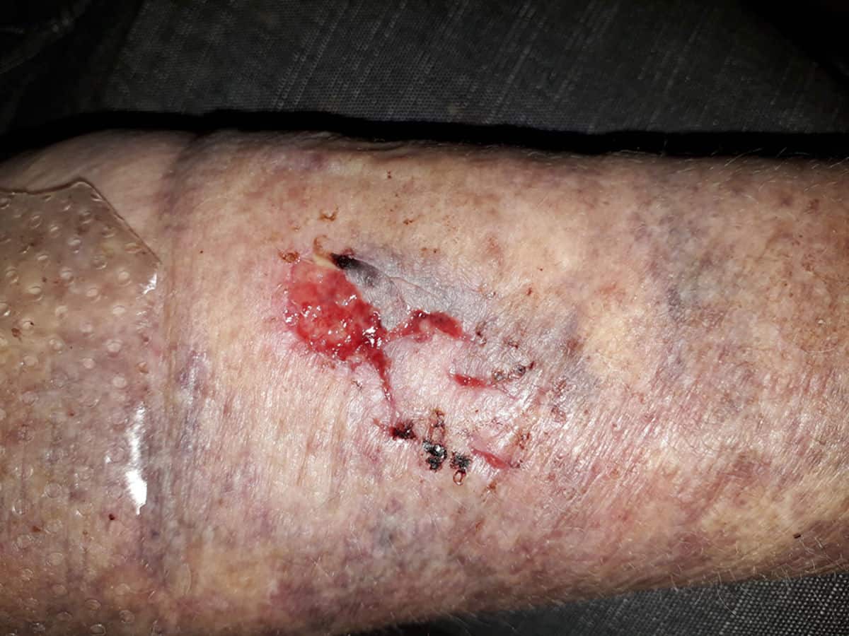 How do I select the right contact layer?