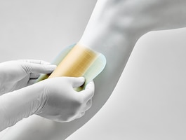 What are the benefits of hydrocolloid dressings?