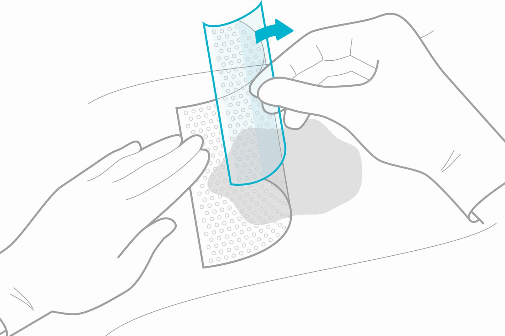 Biatain Contact Dressings