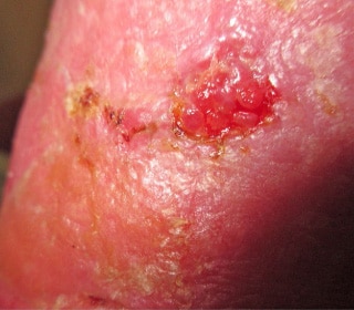 Effective pain management - Case study