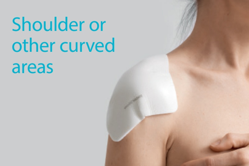 For wounds on the shoulder or other angular areas