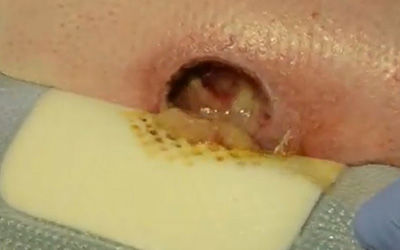 Biatain Silicone - video 2