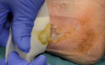 Biatain Silicone - video 3