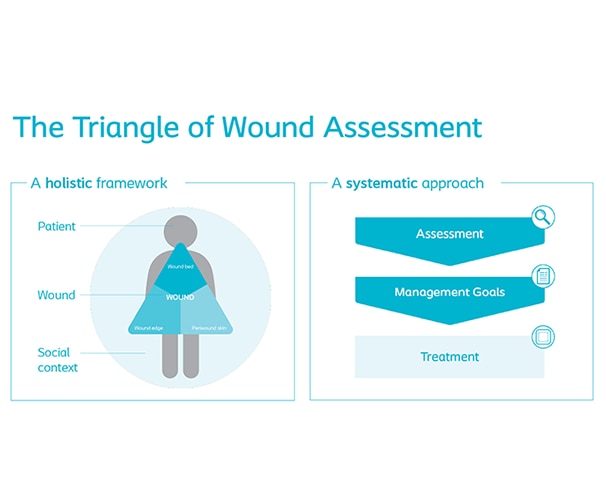 What is the Triangle of Wound Assessment?