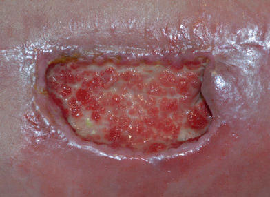 Are there rolled wound edges?